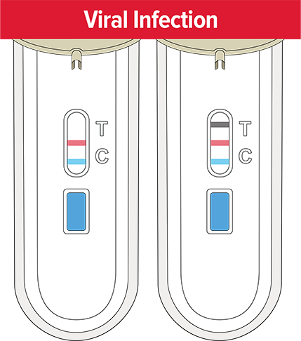 viral infection